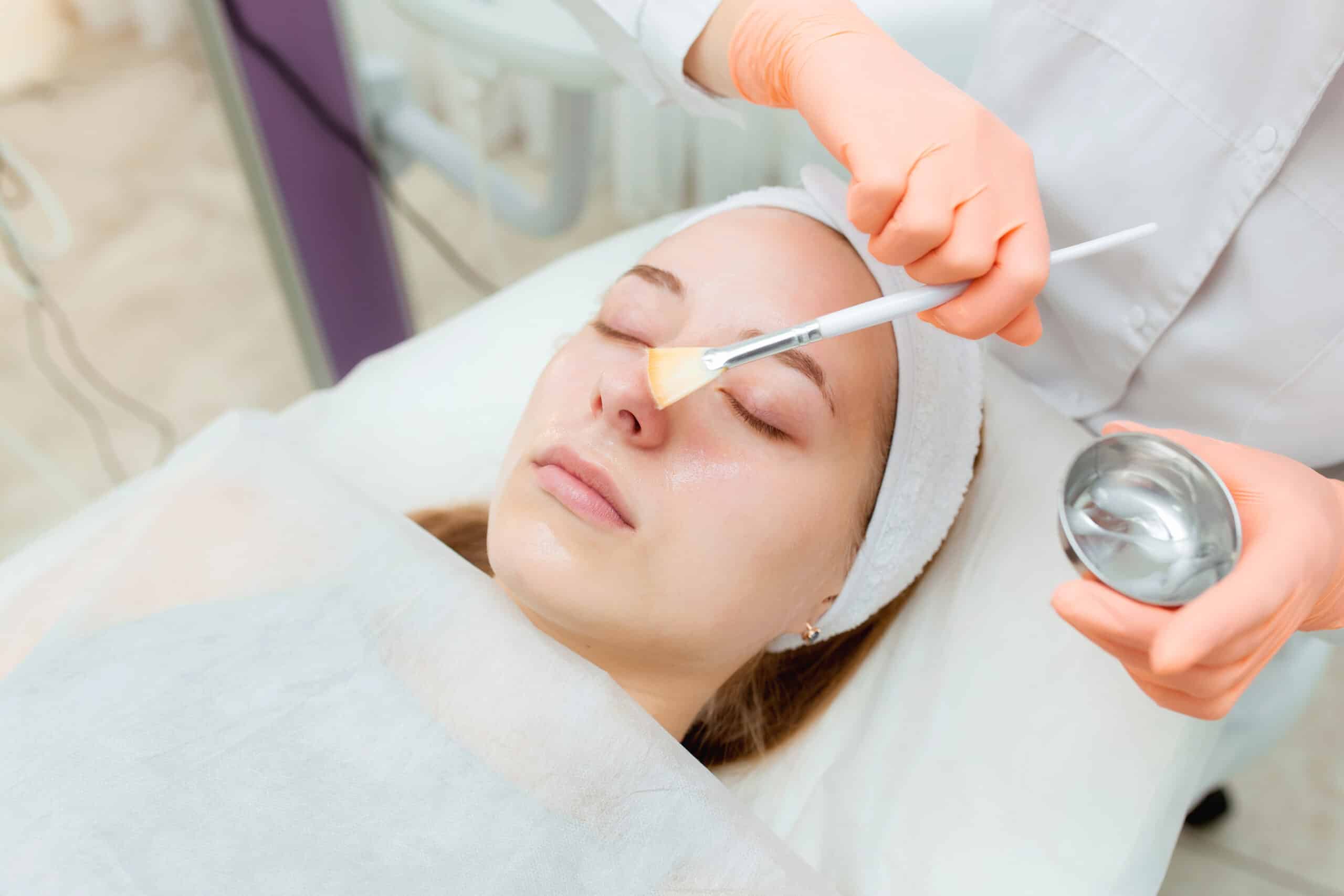 Close-up of a woman receiving a chemical peel treatment at Bloom Med Spa, with a skincare professional applying the solution to exfoliate and renew the skin.