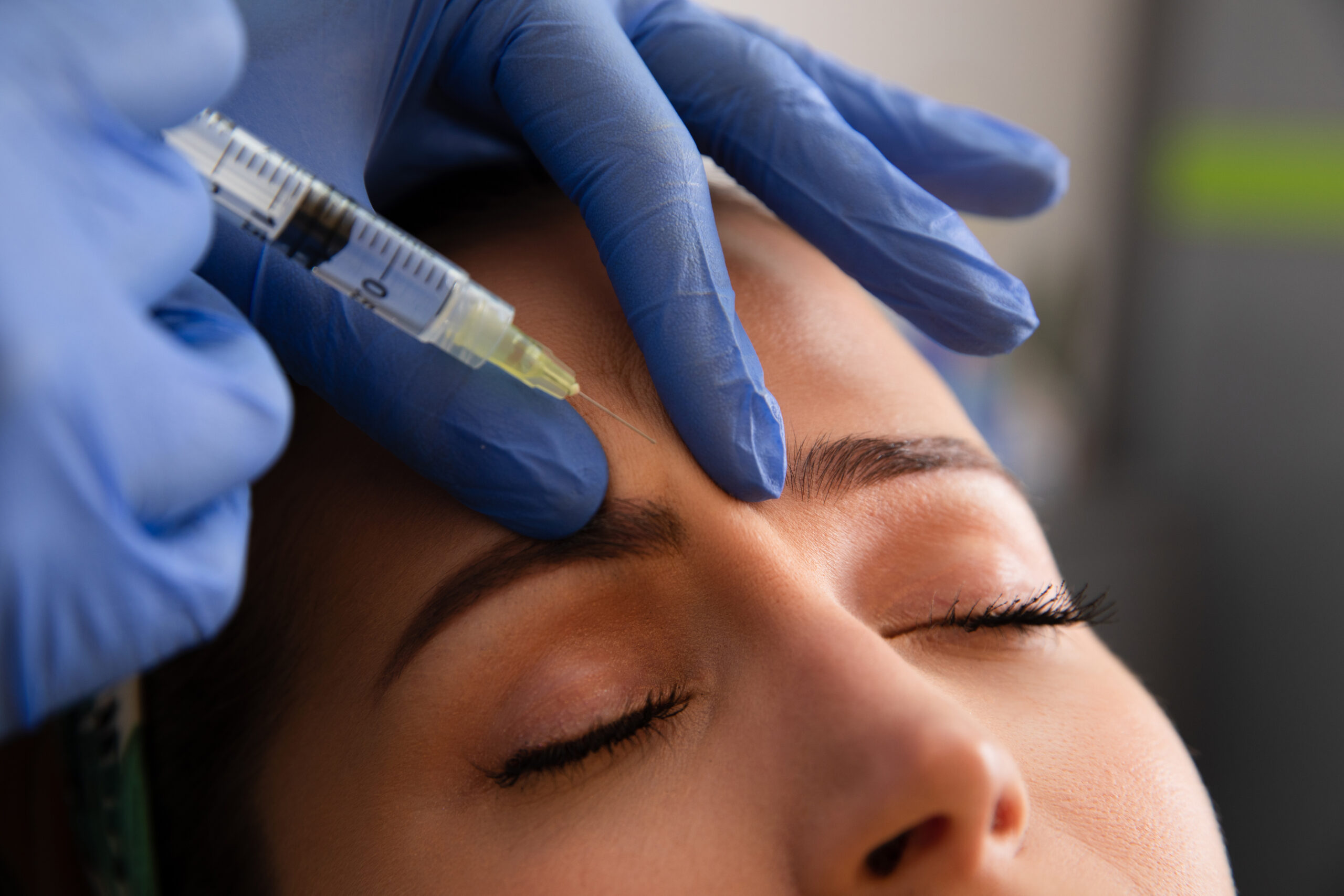 A professional administering Botox injections to a woman’s 11s area between her eyebrows to reduce the appearance of frown lines.