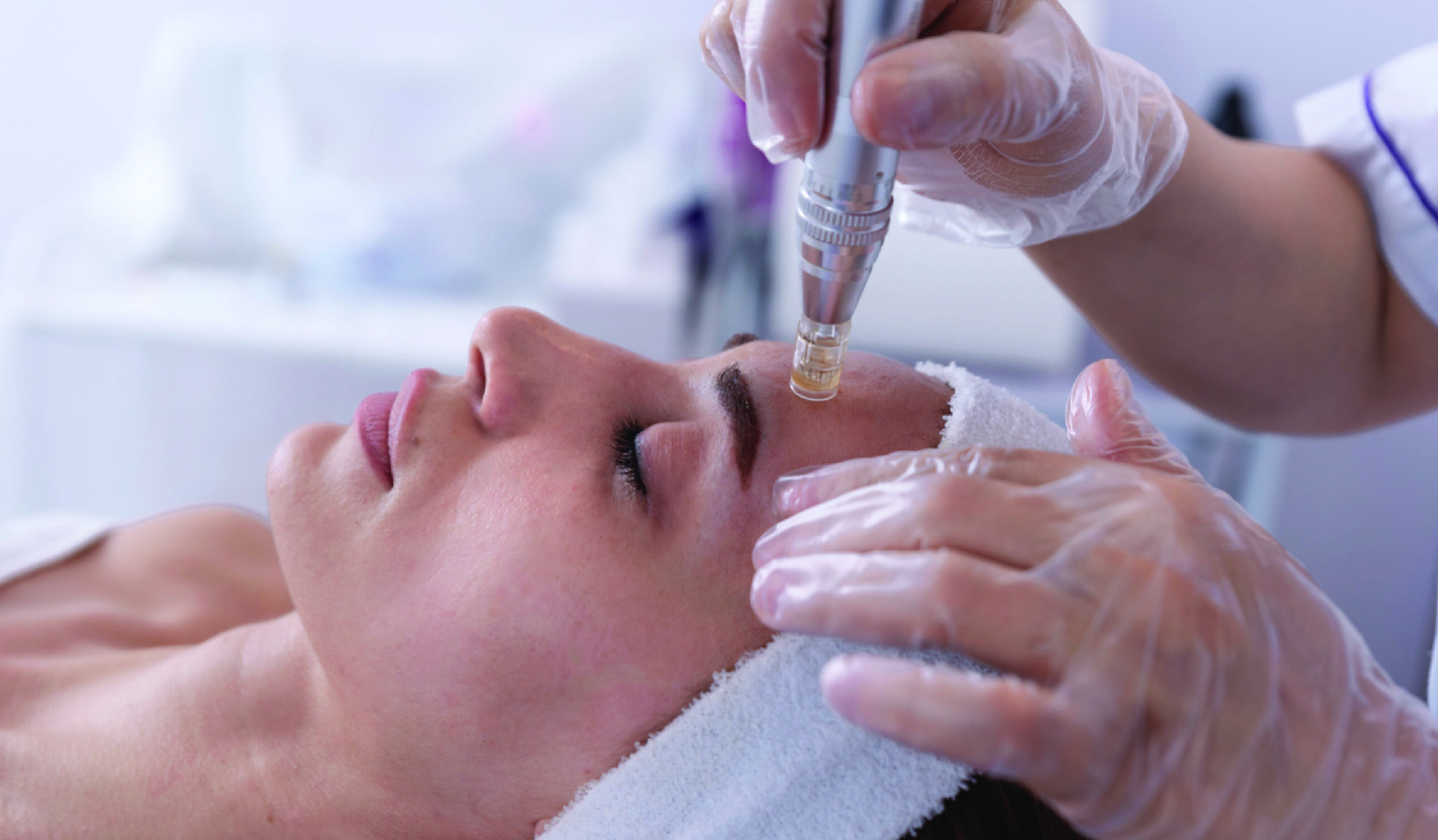 Focused woman undergoing microneedling treatment, with a professional using a handheld device to create micro-punctures on her skin for rejuvenation.