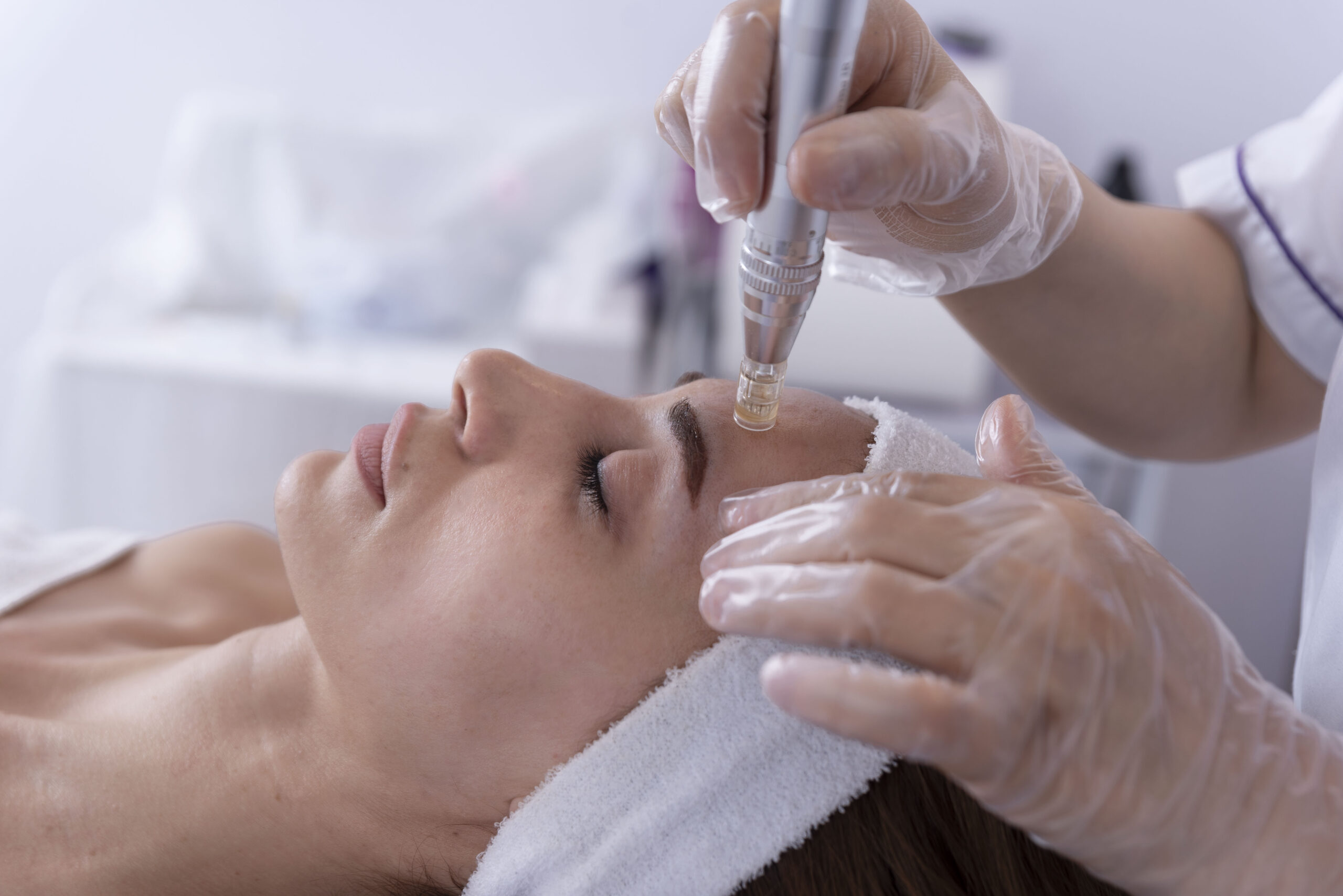 A professional aesthetician carefully performing a Dermapen microneedling treatment on a woman’s face, using the device to improve skin texture and stimulate collagen production.