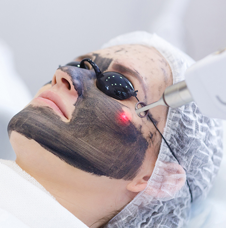 Person receiving the Hollywood Laser Peel treatment at a med spa, with a laser device being gently applied to their face for skin rejuvenation.